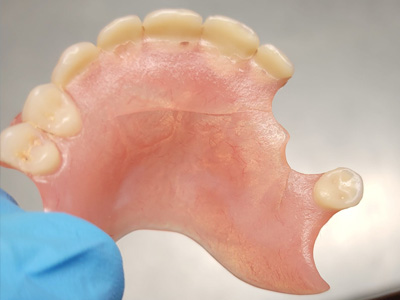 réparation de prothèse dentaire cassée laboratoire Van oostveldt à Mettet namur